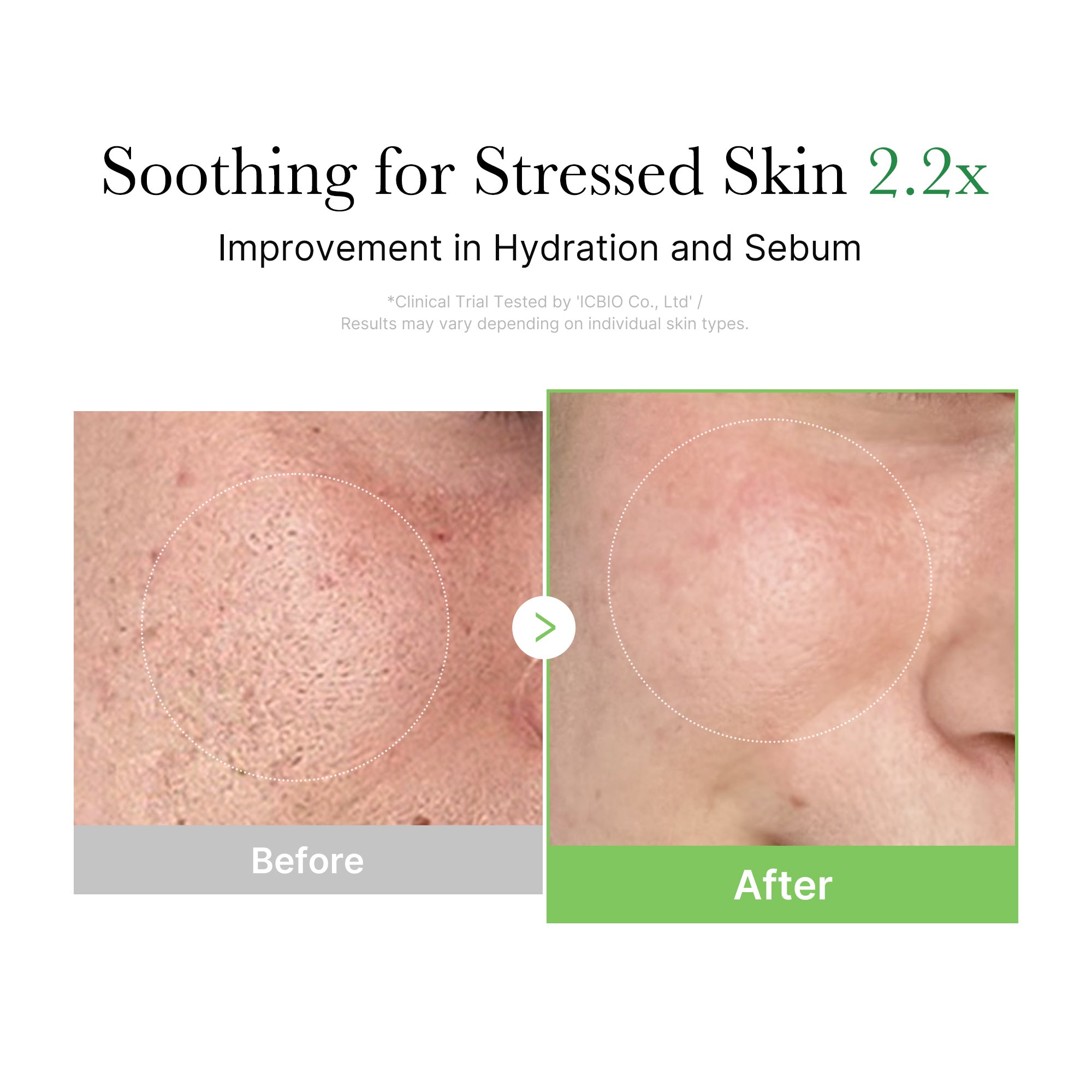 Exosome Cica Calming Full Set